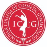 iccg