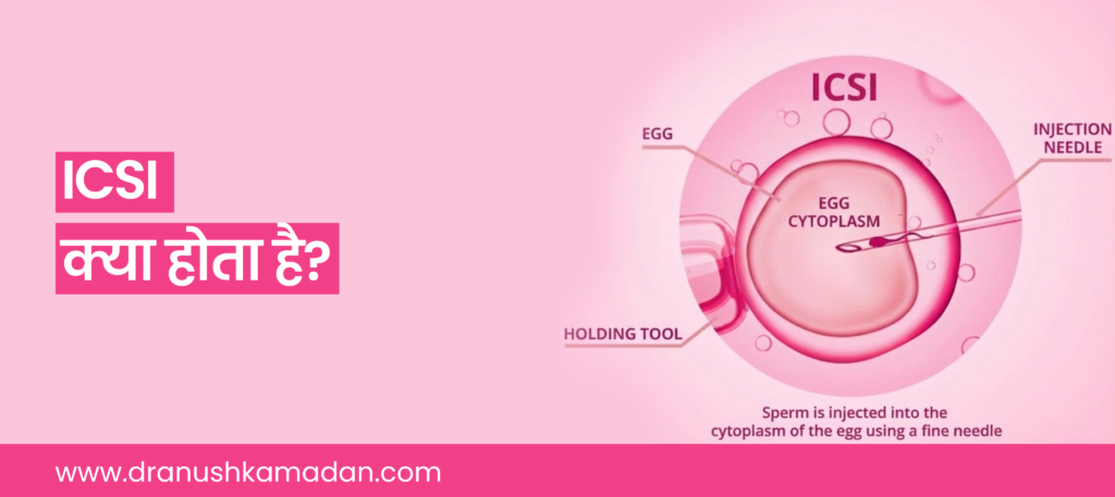 icsi kya hota hai banner