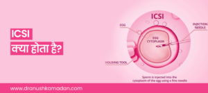 icsi kya hota hai banner