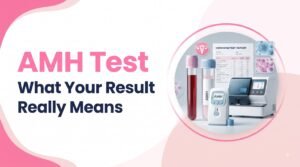 AMH Test